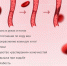 Симптомы тромбоза могут быть неспецифичными, свойственными многим заболеваниям - 76.Ru
